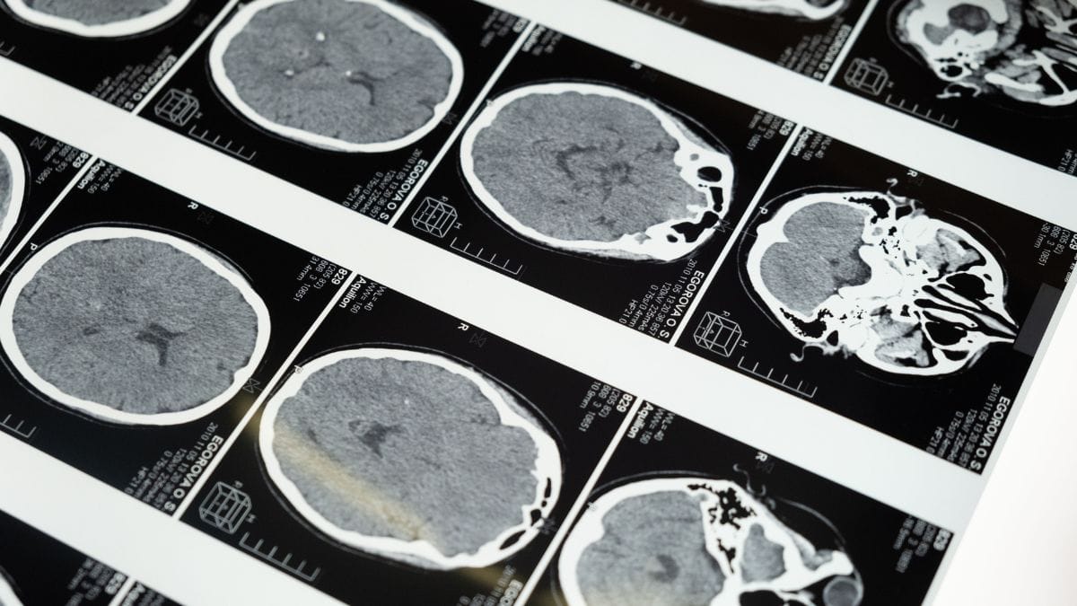 Before a brain can think, stem cells are ‘listening’ to their environment